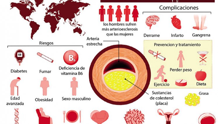 Mapa de arteriosclerosis