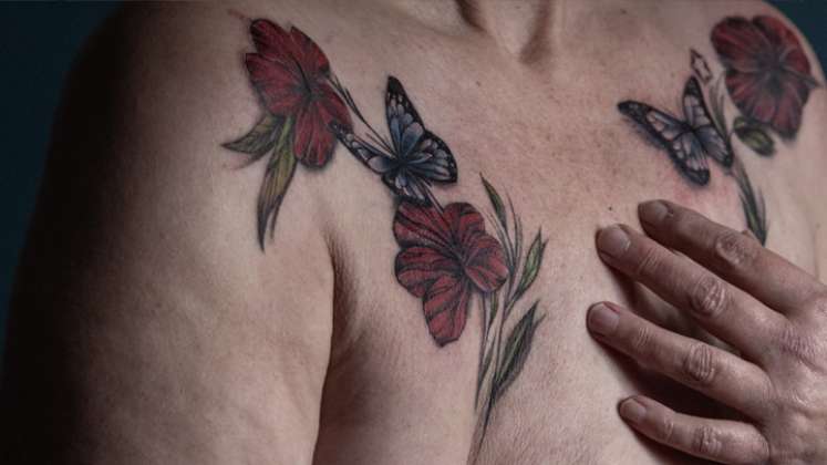 Tatuaje gratuito en los Países Bajos para sobrevivientes del cáncer de seno