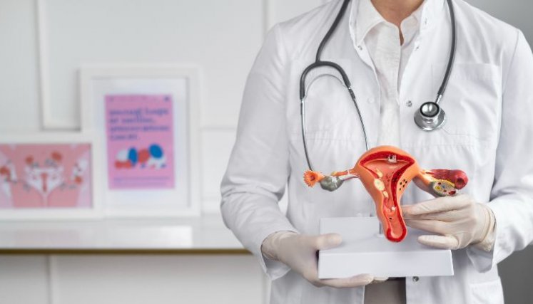 Cáncer de ovario. 