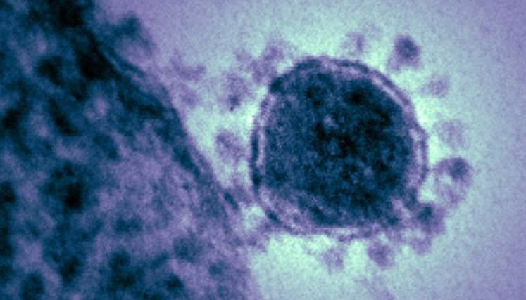 Coronavirus