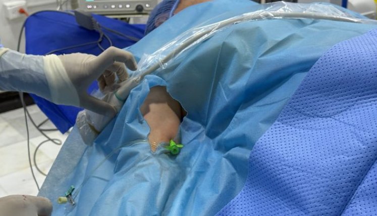 El procedimiento es totalmente ambulatorio y no necesita incapacidad./Foto cortesía