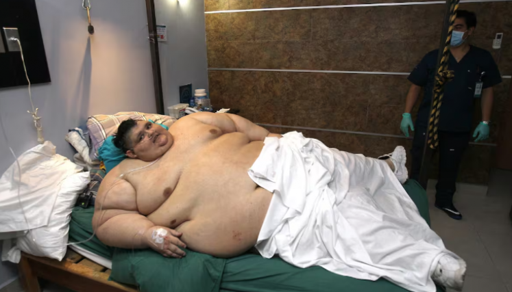 el más obeso del mundo