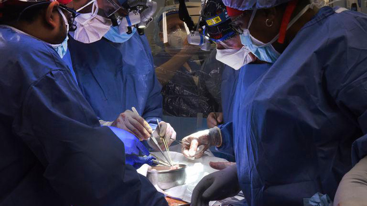 Muere el primer paciente con un corazón de cerdo trasplantado