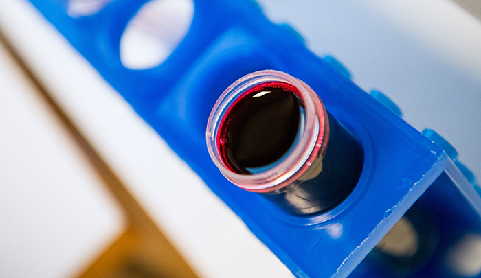 Propagación de la malaria.