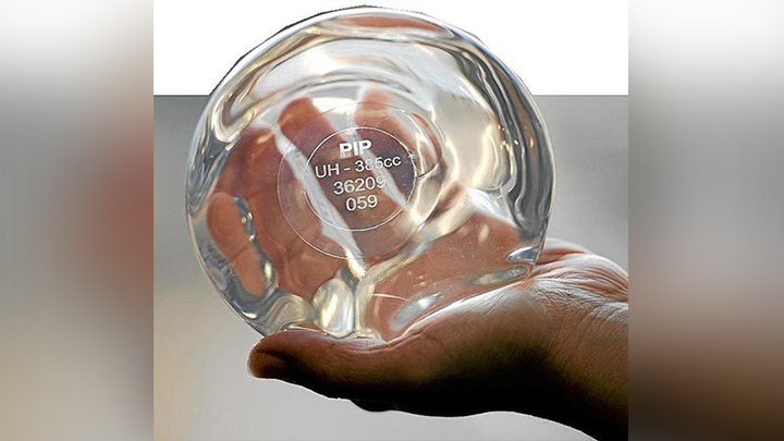 Colombianas, entre las víctimas que serán indemnizadas por prótesis PIP./Foto: Internet