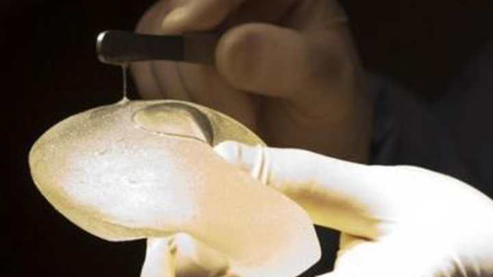 Colombianas, entre las víctimas que serán indemnizadas por prótesis PIP./Foto: Internet