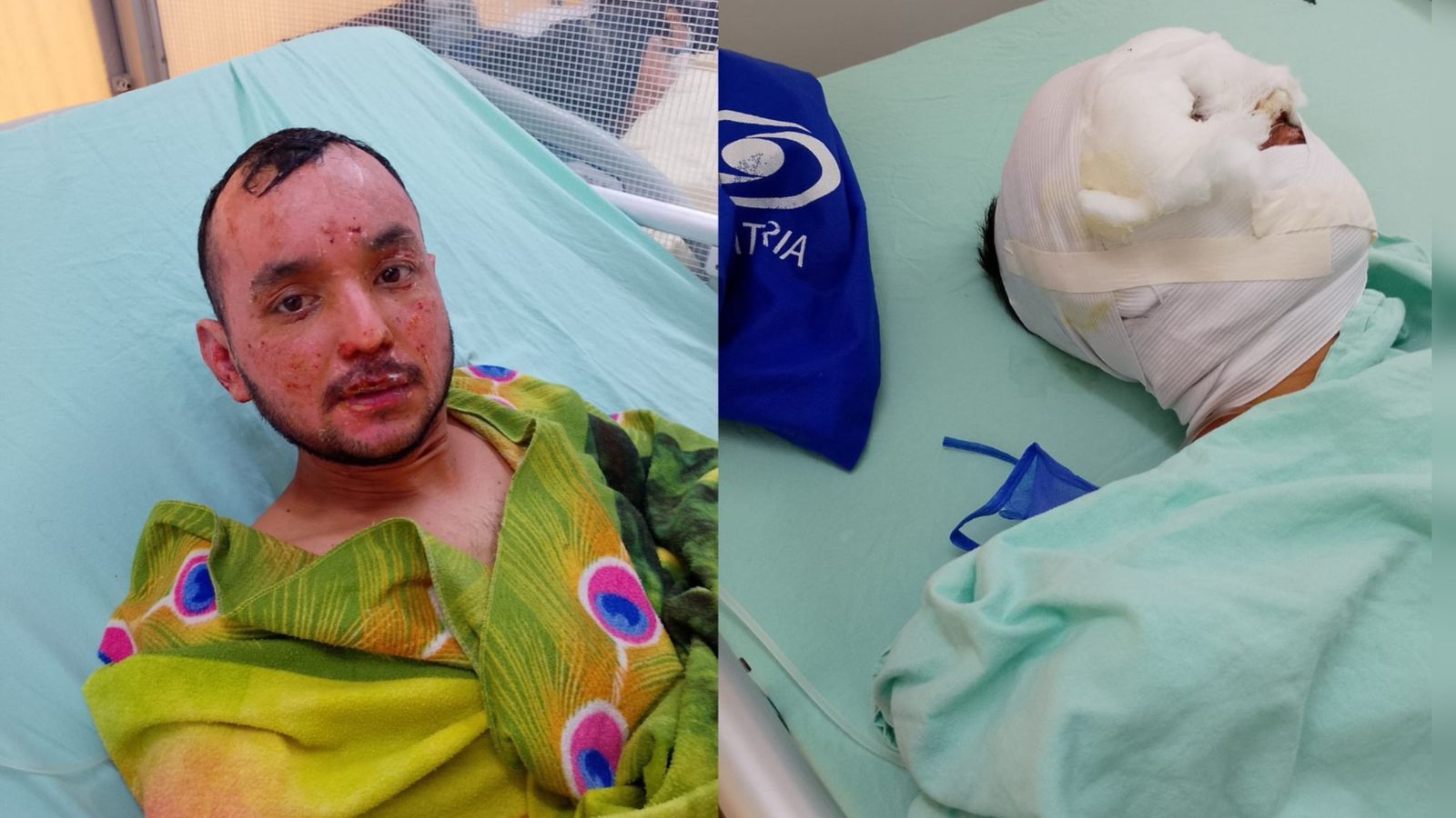 Quemado del macabro caso