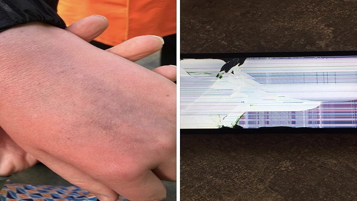 Así quedó la mano y el celular del joven