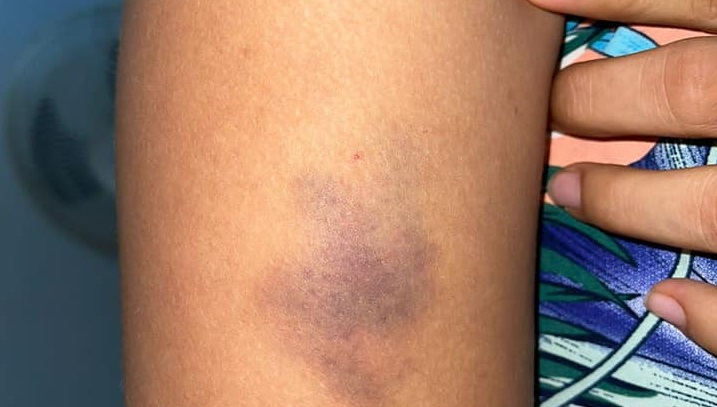 violencia a la mujer