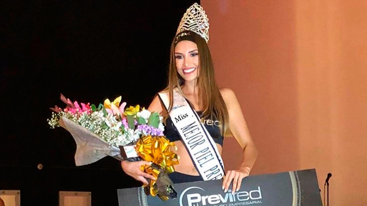 Lizeth Bunzel, Mejor piel.