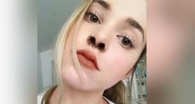 Pelo en la nariz: así es la nueva tendencia en Instagram 