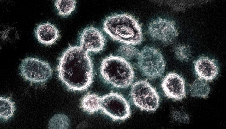 Según los expertos, la transmisión del virus a través de un animal es una hipótesis “entre probable y muy probable”. /Foto: AFP