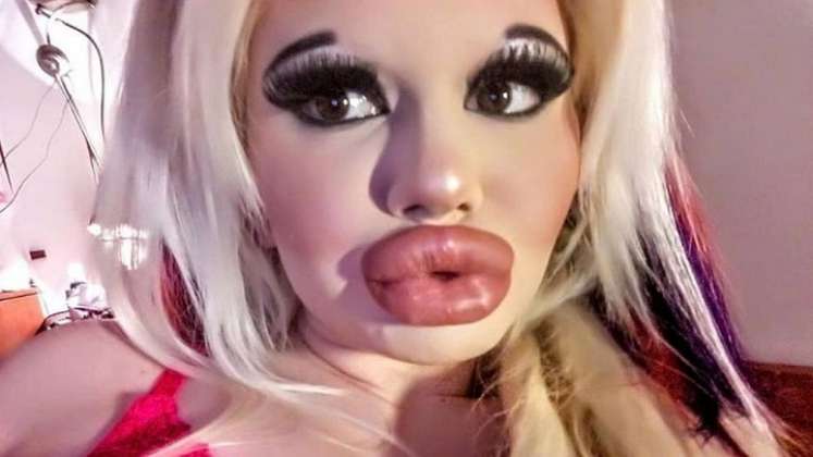 La influencer con los labios más grandes del mundo./FOTO: Tomada de internet