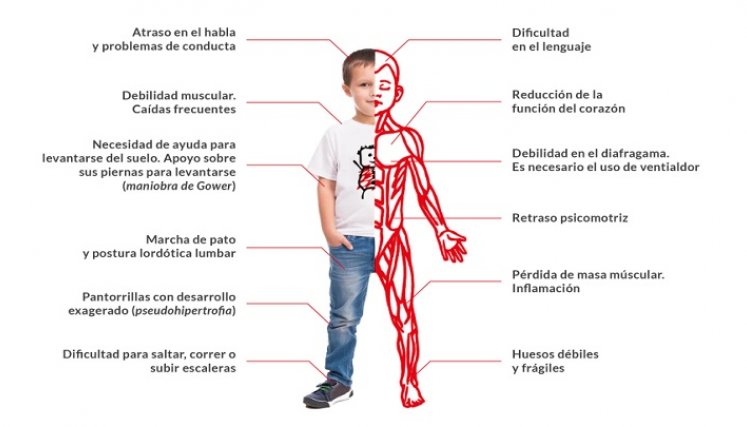 Estos son algunos de los síntomas que se pueden presentar. / Cortesía/ La Opinión 