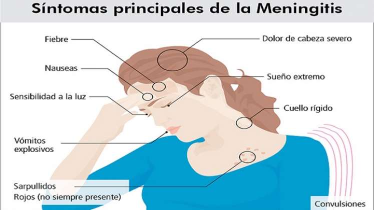 Síntomas de la Meningitis. / Cortesía