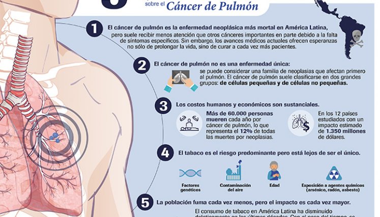 Cáncer de pulmón.