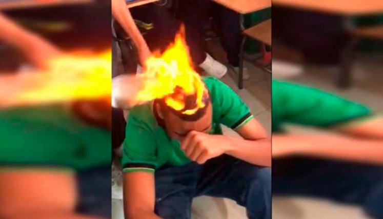 Se incendió el cabello en colegio.