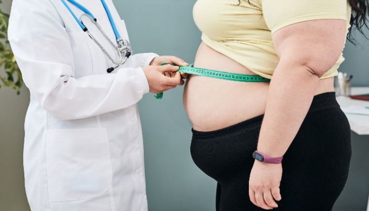 En medio de la pandemia, el exceso de peso fue un factor de riesgo para que las personas llegaran a una UCI./ Foto: Cortesía