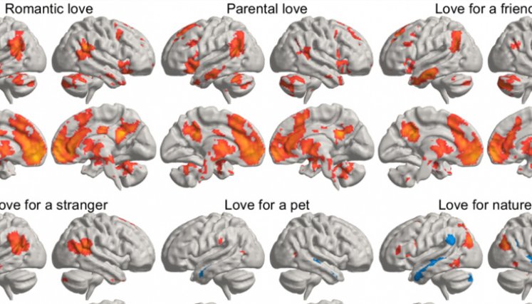 La imagen representa una media estadística de cómo los distintos tipos de amor iluminan diferentes regiones del cerebro.