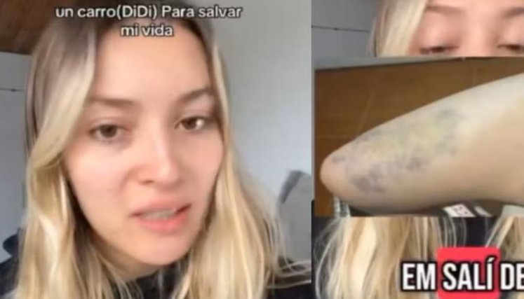 Mujer atacada en un servicio de Didi