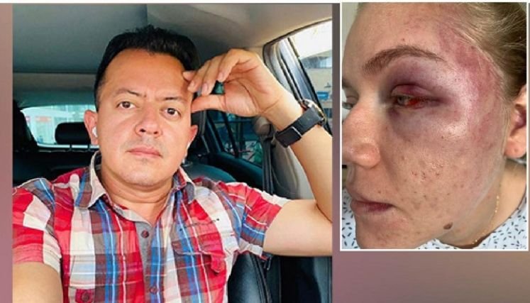 Cuatro años después, el concejal que le pegó a la compañera sentimental fue suspendido por la Procuraduría Provincial de Ocaña.