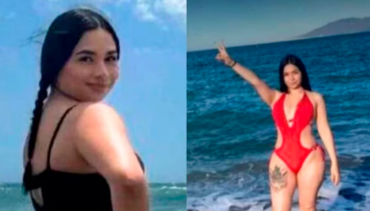 murió tras liposucción 