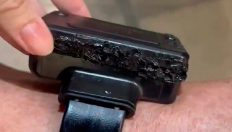 Tobillera de Jair Bolsonaro dañada por un soldador