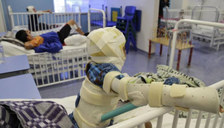 Quemados por polvora