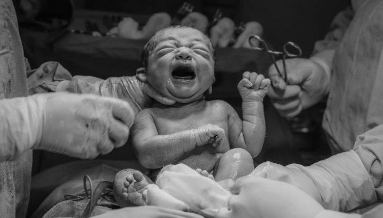 En 2025, en el Hospital Erasmo Meoz, nacieron  33 por ciento menos bebés que en los últimos cinco años./Foto cortesía