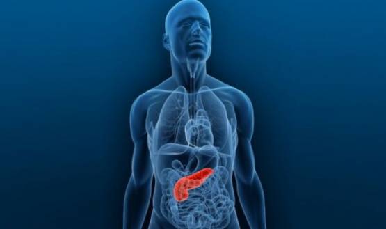 Cáncer de páncreas