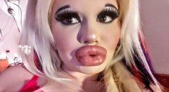 La influencer con los labios más grandes del mundo./FOTO: Tomada de internet