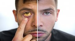 ¿Acostumbra a automedicarse con acetaminofén? Cuidado la sobredosis puede causar hepatitis./Foto: cortesía Nueva EPS