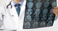 A medida que avanza la pandemia en el mundo, las investigaciones científicas encuentran nuevas marcas que deja la enfermedad, como lo son las afectaciones neurológicas. / Foto: Freepik