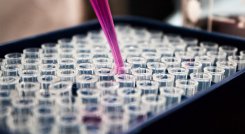 Una de las ventajas fundamentales de la implementación de terapias innovadoras y avanzadas se refleja en la reducción de los costos sociales que generan esta clase de enfermedades multisistémicas y de manejo complejo. / Foto: Cortesía