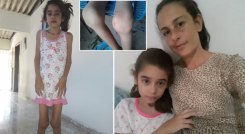 Alexamar Rodríguez Freitez, de 10 años, quien desde los 4 padece artritis idiopática juvenil. / Foto: Cortesúa