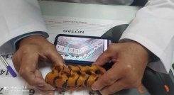 Imagen sobre cómo se lesionó Egan Bernal la columna, tras el choque contra el autobús.