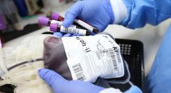  El informe no especifica cómo se dio la pérdida de las unidades de glóbulos rojos. / Foto: Colprensa