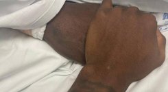 Estado de salud de Freddy Rincón