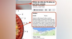 Venta de organos en Venezuela