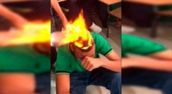 Se incendió el cabello en colegio.