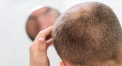 Aprueban píldoras para la caída del cabello. 