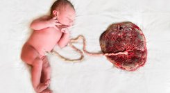 ¿Qué pasa si se come la placenta después del parto?