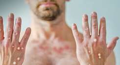 El primer paciente contagiado en la ciudad tiene 40 años y ya se recuperó.  / Foto: Cortesía / La Opinión 