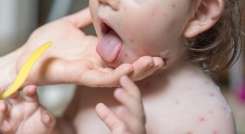 Para prevenir la enfermedad se requiere un adecuado lavado de manos. / Foto : Cortesía 