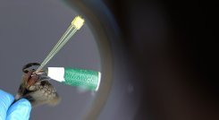 Disfunción eréctil