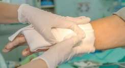 En Norte de Santander, para el periodo 2022-2023, 72 personas resultaron quemadas con pólvora, resaltando que los primeros lesionados se reportaron el 8 de diciembre de 2022./ Foto Cortesía / La Opinión 