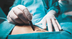 Más de 40 mujeres contrajeron una infección durante cirugía estética en Medellín. 