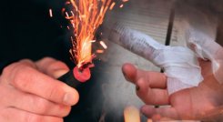 Comenzó diciembre y ya hay quemados por pólvora en Norte de Santander. / Foto: Cortesía / La Opinión