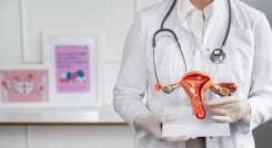 Cáncer de ovario. 
