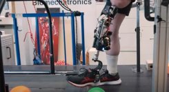 Nuevo-estilo-de-protesis